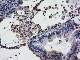 Anti-CYB5R3 antibody [2A10] used in IHC (Paraffin sections) (IHC-P). GTX84646