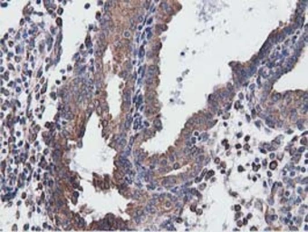 Anti-CYB5R3 antibody [2A10] used in IHC (Paraffin sections) (IHC-P). GTX84646
