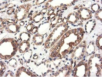 Anti-CYB5R3 antibody [2A10] used in IHC (Paraffin sections) (IHC-P). GTX84646