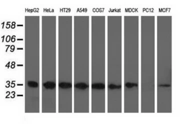 Anti-CYB5R3 antibody [2A10] used in Western Blot (WB). GTX84646