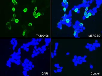 Anti-CTAG1B antibody [3F10] used in Immunocytochemistry/ Immunofluorescence (ICC/IF). GTX84651