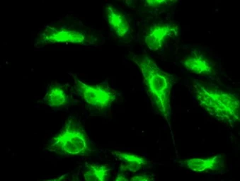 Anti-CTAG1B antibody [3F10] used in Immunocytochemistry/ Immunofluorescence (ICC/IF). GTX84651
