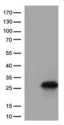 Anti-CTAG1B antibody [3F10] used in Western Blot (WB). GTX84651