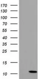 Anti-COX6B2 antibody [1F5] used in Western Blot (WB). GTX84668