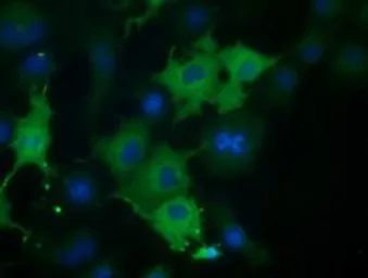 Anti-Coronin 1B antibody [3D10] used in Immunocytochemistry/ Immunofluorescence (ICC/IF). GTX84676