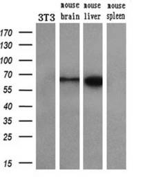 Anti-Coronin 1B antibody [3D10] used in Western Blot (WB). GTX84676