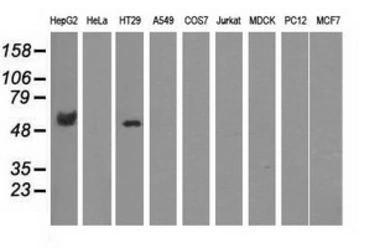 Anti-Coronin 1B antibody [3D10] used in Western Blot (WB). GTX84676