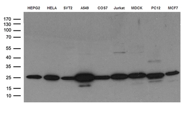 Anti-CLPP antibody [1D3] used in Western Blot (WB). GTX84678