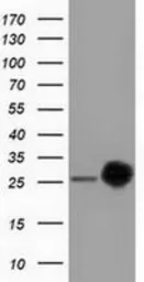 Anti-CLPP antibody [1D3] used in Western Blot (WB). GTX84678