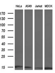 Anti-CISD1 antibody [2B3] used in Western Blot (WB). GTX84683