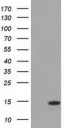 Anti-CISD1 antibody [2B3] used in Western Blot (WB). GTX84683