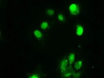Anti-Chk2 antibody [5C4] used in Immunocytochemistry/ Immunofluorescence (ICC/IF). GTX84691