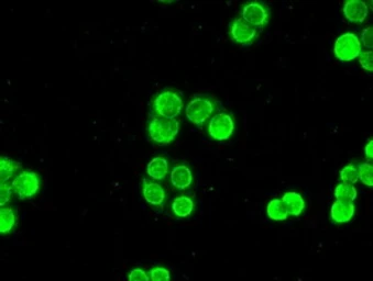 Anti-Chk2 antibody [5C4] used in Immunocytochemistry/ Immunofluorescence (ICC/IF). GTX84691