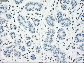 Anti-Chk2 antibody [5C4] used in IHC (Paraffin sections) (IHC-P). GTX84691