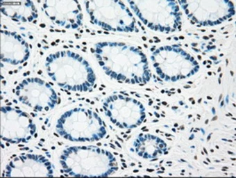 Anti-Chk2 antibody [5C4] used in IHC (Paraffin sections) (IHC-P). GTX84691