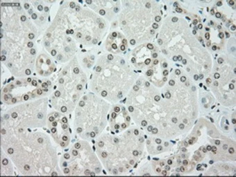 Anti-Chk2 antibody [5C4] used in IHC (Paraffin sections) (IHC-P). GTX84691