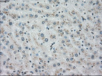 Anti-Chk2 antibody [5C4] used in IHC (Paraffin sections) (IHC-P). GTX84691