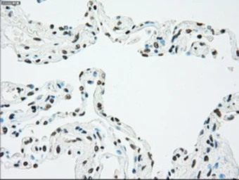 Anti-Chk2 antibody [5C4] used in IHC (Paraffin sections) (IHC-P). GTX84691