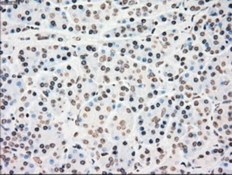 Anti-Chk2 antibody [5C4] used in IHC (Paraffin sections) (IHC-P). GTX84691