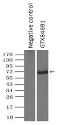 Anti-Chk2 antibody [5C4] used in Immunoprecipitation (IP). GTX84691