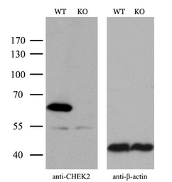 Anti-Chk2 antibody [5C4] used in Western Blot (WB). GTX84691