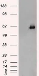 Anti-Chk2 antibody [5C4] used in Western Blot (WB). GTX84691