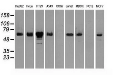 Anti-Chk2 antibody [5C4] used in Western Blot (WB). GTX84691