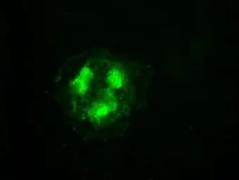 Anti-CDK5 antibody [2H6] used in Immunocytochemistry/ Immunofluorescence (ICC/IF). GTX84696