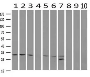 Anti-CDK5 antibody [2H6] used in Western Blot (WB). GTX84696