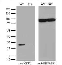Anti-CDK5 antibody [2H6] used in Western Blot (WB). GTX84696