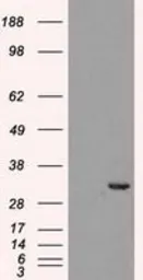 Anti-CDK5 antibody [2H6] used in Western Blot (WB). GTX84696
