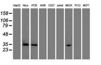Anti-CDK5 antibody [2H6] used in Western Blot (WB). GTX84696