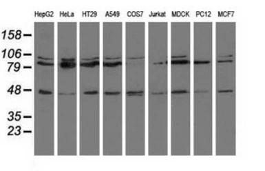 Anti-CD80 antibody [1E9] used in Western Blot (WB). GTX84698