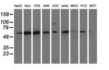 Anti-CD80 antibody [7H3] used in Western Blot (WB). GTX84702
