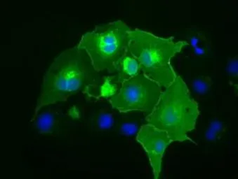 Anti-CD5 antibody [2B8] used in Immunocytochemistry/ Immunofluorescence (ICC/IF). GTX84708