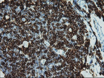 Anti-CD5 antibody [2B8] used in IHC (Paraffin sections) (IHC-P). GTX84708