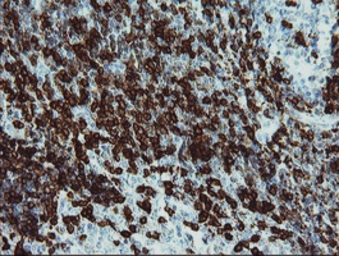 Anti-CD5 antibody [2B8] used in IHC (Paraffin sections) (IHC-P). GTX84708