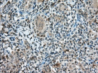 Anti-CD5 antibody [7A7] used in IHC (Paraffin sections) (IHC-P). GTX84709