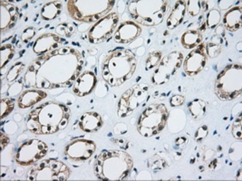 Anti-CD5 antibody [7A7] used in IHC (Paraffin sections) (IHC-P). GTX84709