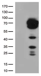 Anti-CD5 antibody [7A7] used in Western Blot (WB). GTX84709
