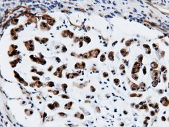Anti-CBWD1 antibody [3F9] used in IHC (Paraffin sections) (IHC-P). GTX84732