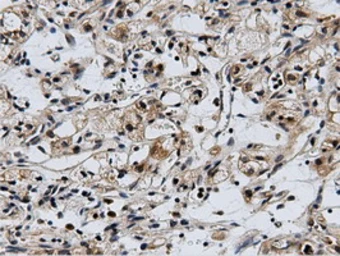 Anti-CBWD1 antibody [3F9] used in IHC (Paraffin sections) (IHC-P). GTX84732