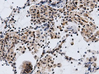 Anti-CBWD1 antibody [3F9] used in IHC (Paraffin sections) (IHC-P). GTX84732