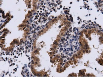 Anti-CBWD1 antibody [3F9] used in IHC (Paraffin sections) (IHC-P). GTX84732