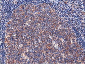 Anti-CBWD1 antibody [3F9] used in IHC (Paraffin sections) (IHC-P). GTX84732