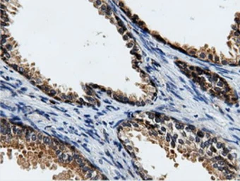 Anti-CBWD1 antibody [3F9] used in IHC (Paraffin sections) (IHC-P). GTX84732