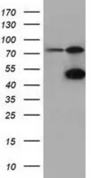 Anti-CBWD1 antibody [3F9] used in Western Blot (WB). GTX84732