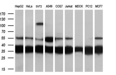 Anti-CAPZA1 antibody [2G4] used in Western Blot (WB). GTX84737