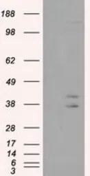 Anti-CAPZA1 antibody [2G4] used in Western Blot (WB). GTX84737