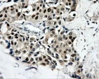 Anti-CaMKI delta antibody [2C6] used in IHC (Paraffin sections) (IHC-P). GTX84738